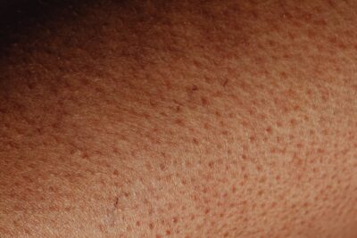 How to Get Rid of Textured Skin