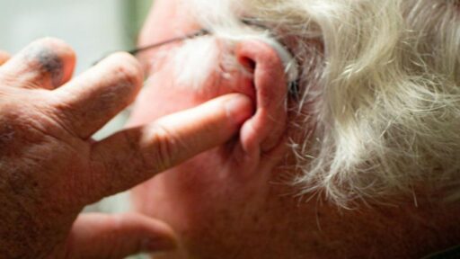 does-medicaid-cover-hearing-aid-featured