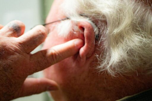 does-medicaid-cover-hearing-aid-featured