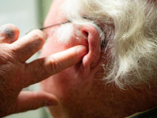 does-medicaid-cover-hearing-aid-featured